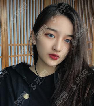 刚看到刘仁娜整容前后照片对比,让我找到了上海华美进行面部吸脂手术