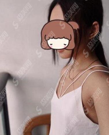 上海时光整形美容医院价目表2021,内含妙桃丰胸真实果图