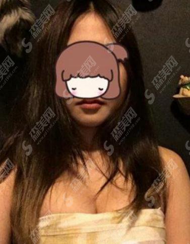 上海时光整形美容医院价目表2021,内含妙桃丰胸真实果图