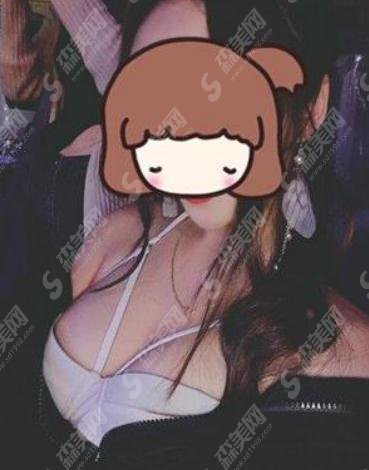 上海时光整形美容医院价目表2021,内含妙桃丰胸真实果图