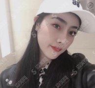 上海九院整形科价目表2021，眼科整形贵吗？内含眼部手术案例展示