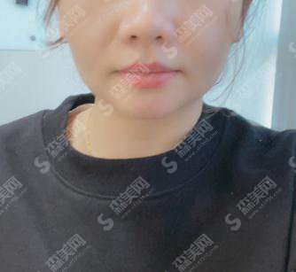 昆明美立方整形医院情况如何？医院概述/医生名单/案例展示