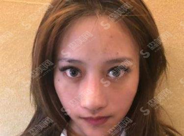 郑州一科整形医院口碑好不好？医院概述//案例亲身展示