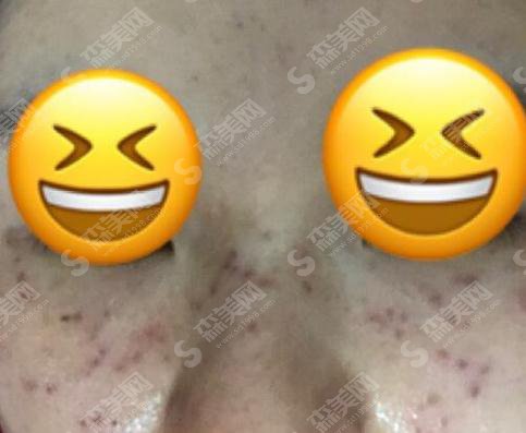 西京医院整形科设备先进吗?医院概述/医生信息/激光祛斑果