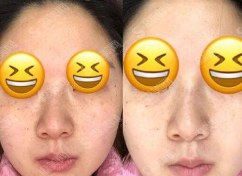 西京医院整形科设备先进吗?医院概述/医生信息/激光祛斑果