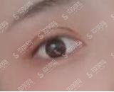 西安西京整形外科中心怎么样?价格贵吗？附西安西京整形外科中心介绍及整形手术成功案例分享