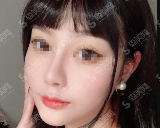 重庆铜雀台医院正规吗?重庆铜雀台医院做的鼻子怎么样?附医师简介及案例分享