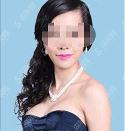 郑州华山医院怎么样?郑州华山医院做的隆胸果好不好