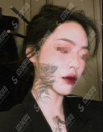 梧州的隆鼻医院华美实力怎么样？梧州隆鼻的果好不好？附医师介绍及案例分享