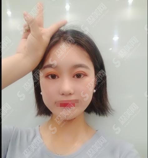 奥雅整形医院怎么样？奥雅整形做的双眼皮怎么样？附医师介绍及案例分享