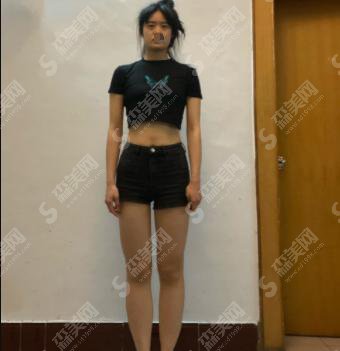 广州壹加壹整形医院怎么样？广州壹加壹整形医院做的整形果好不好？附医师介绍及案例分享