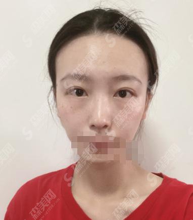 上海时光整形怎么样？上海时光整形做的鼻子果好不好？附医师介绍及案例分享
