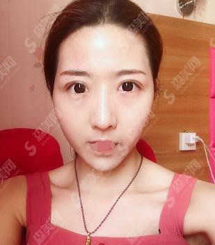 西安整形科哪个医院好？西安西美整形医院做的整形果好不好？附医师介绍及案例分享