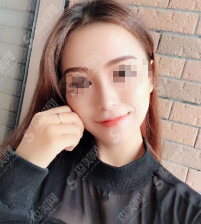 郑州美立方整形医院怎么样?郑州美立方做的鼻子怎么样?附医师介绍及案例分享