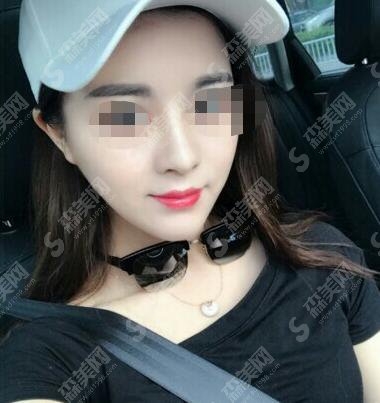 吉大一院整形科怎么样?吉大医院张舵做的鼻子怎么样?附医师介绍及案例分享