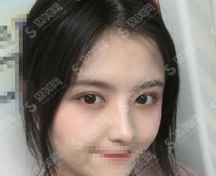 湘雅医院整形科口碑好吗?医院概述/项目价格/案例展示