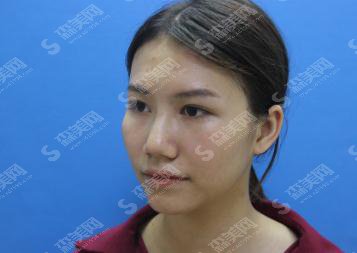 杭州邵逸夫整形美容科口碑可以吗?医院概述/医生名单/案例展示