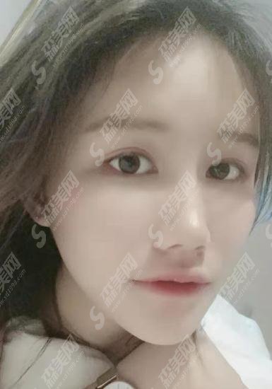 杭州邵逸夫整形美容科口碑可以吗?医院概述/医生名单/案例展示