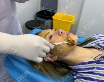 北京同仁整形医院价目表2021,内含面部吸脂的具体果浏览