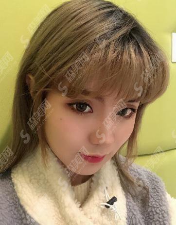 北京同仁整形医院价目表2021,内含面部吸脂的具体果浏览