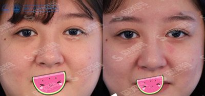 成都八大处医生专家有哪些?专家名录&光子美肤的果