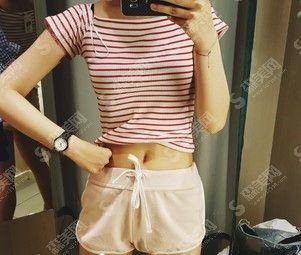 成都八大处整形价目表2020,吸脂瘦身怎么样?内附吸脂较新价目表