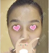 北京八大处整形医院整形价目表2020,八大处的面部填充怎么样?面部填充的较新价目表