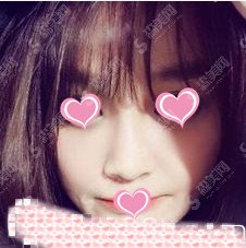 北京八大处整形医院整形价目表2020,八大处的面部填充怎么样?面部填充的较新价目表