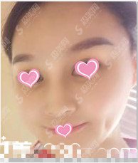 北京八大处整形医院整形价目表2020,八大处的面部填充怎么样?面部填充的较新价目表