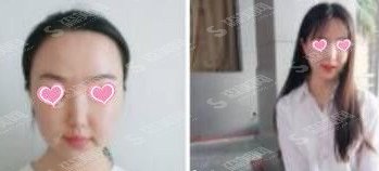 上海九院整形价格表(价目表)曝光，内附专家医生推荐案&例前后对比图