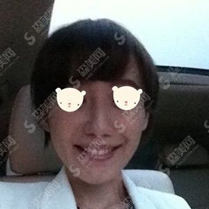 美白牙齿价目表2020,牙齿美白好不好?牙齿美白的恢复果图