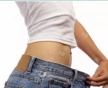 腰腹部环吸多少钱？腰腹环吸有哪些优点呢？