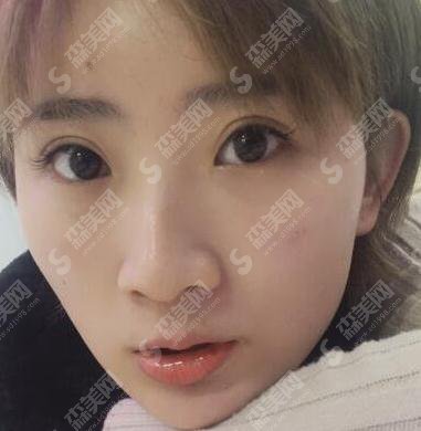 四川华西医院美容整形科口碑怎么样？医生排名/医院简述/案例日记