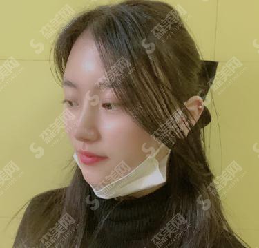 上海九院价格表2021,附鼻部综合案例前后对比照片