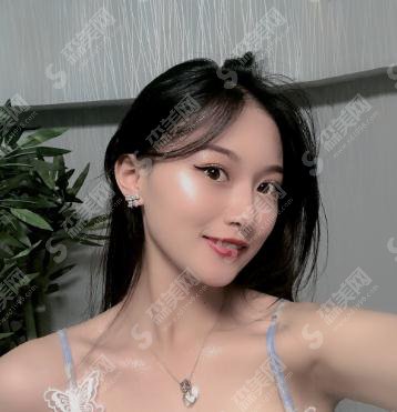 上海九院价格表2021,附鼻部综合案例前后对比照片