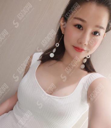嘉兴曙光整形医院价目表2021,内含吸脂隆胸的具体果
