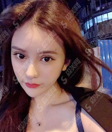 北京八大处整形美容价目表2021,内含自体脂肪全脸填充具体果图