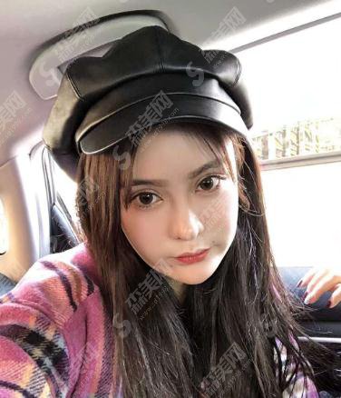 北京八大处整形美容价目表2021,内含自体脂肪全脸填充具体果图