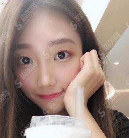 上海九院去眼袋需要多少钱？2021较新价格表，内含去眼袋果