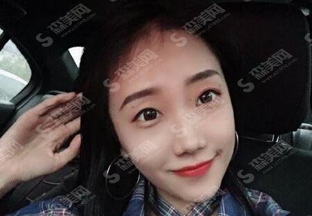 上海九院去眼袋需要多少钱？2021较新价格表，内含去眼袋果