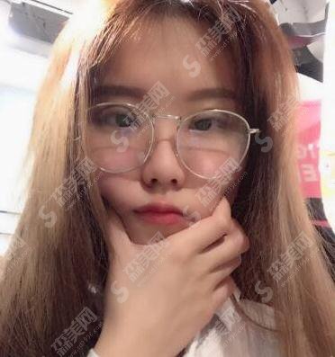 北京京民医院整形价目表2021，内含郭建玲割双眼皮的具体果图浏览