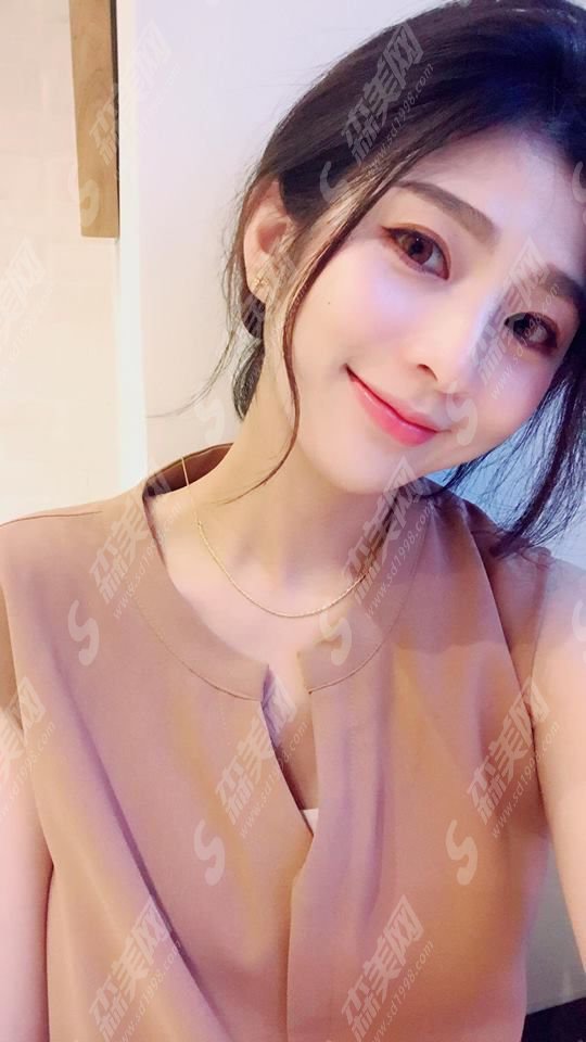 玻尿酸隆鼻整形价目表2020,玻尿酸隆鼻整形怎么样?内含玻尿酸隆鼻的果恢复图