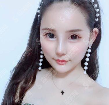 哈医大二院激光美容科价目表2021，内含耳软骨隆鼻详情分析