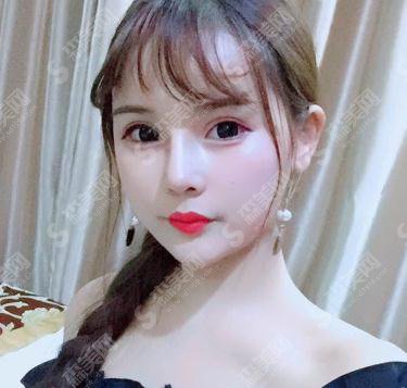 哈医大二院激光美容科价目表2021，内含耳软骨隆鼻详情分析