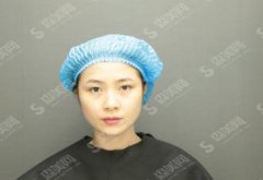 西京医院整形科价目表2021,内含光子嫩肤果详情比对