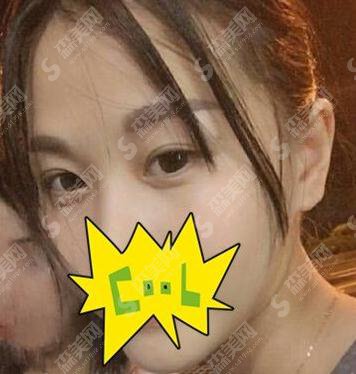 上海美联臣整形医院怎么样？医院概述/医生名单/案例展示