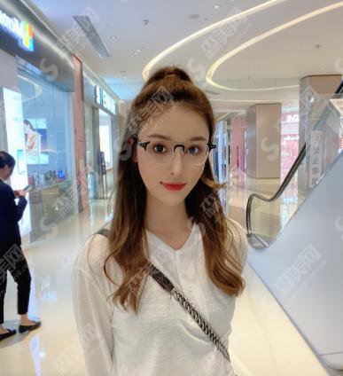 沈阳杏林整形医院价格表2021，附唇部整形案例真实果