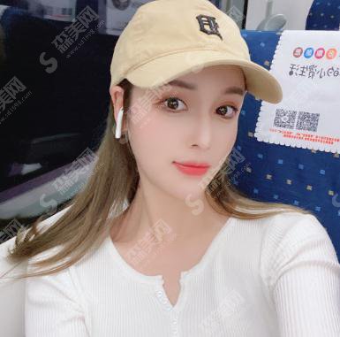 沈阳杏林整形医院价格表2021，附唇部整形案例真实果