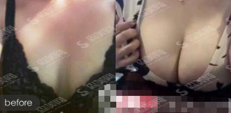 北京盛嘉荣医疗美容医院正规吗?医院概述/医生简介/案例展示