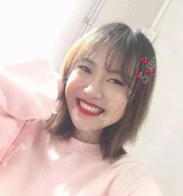 上海九院口腔科价目表2021,内含汪勇正畸案例前后对比图